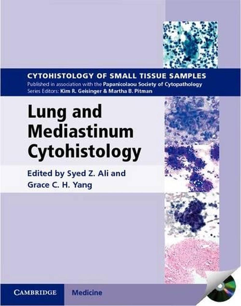 Lung and Mediastinum Cytohistology with CD-ROM, 9780521516587