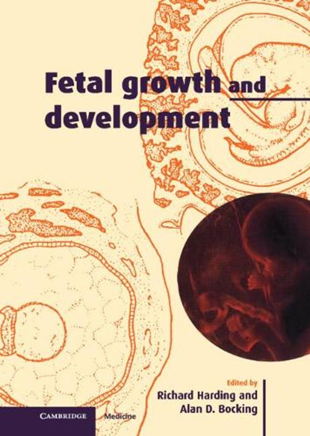 Fetal Growth and Development by Alan D. Bocking, Hardcover ...