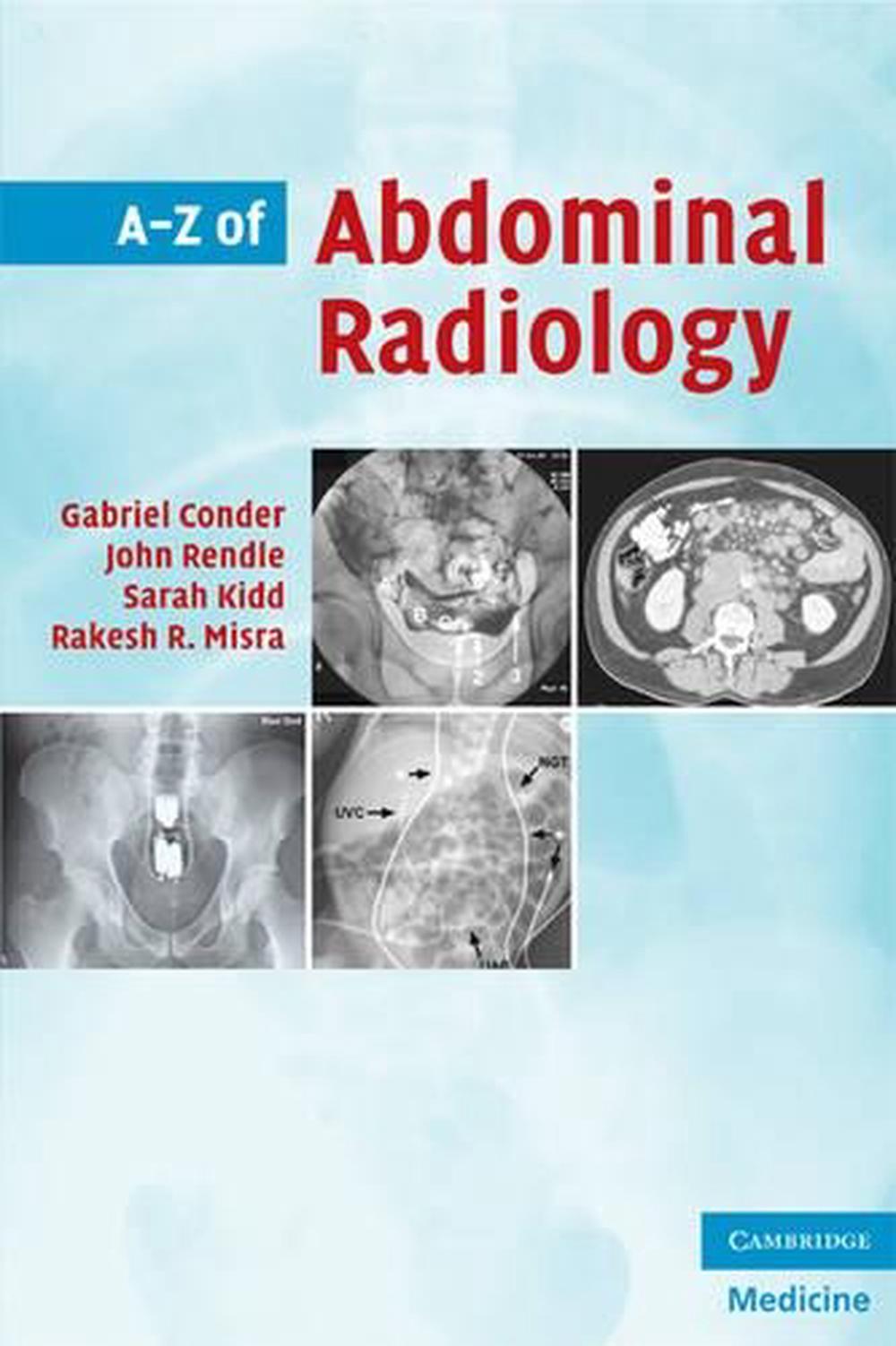 A-Z of Abdominal Radiology, 9780521700146
