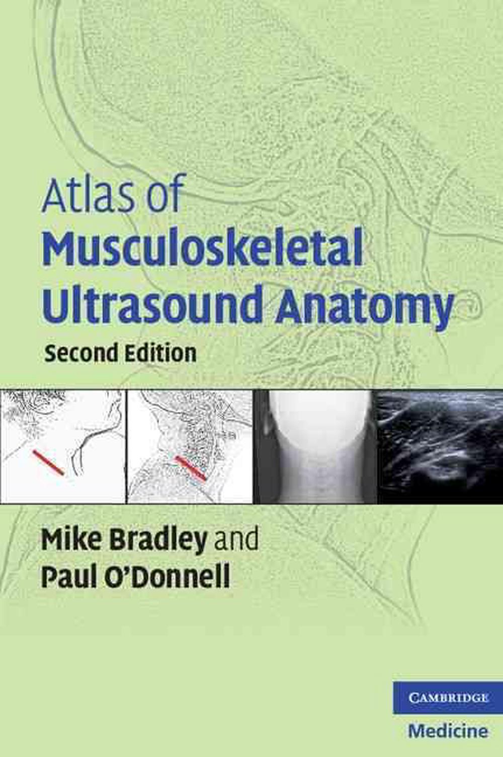 Atlas Of Musculoskeletal Ultrasound Anatomy By Mike Bradley, Paperback ...