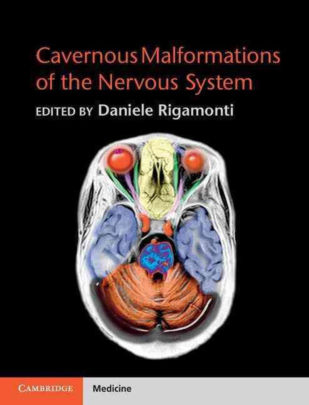 Cavernous Malformations of the Nervous System, 9780521764278