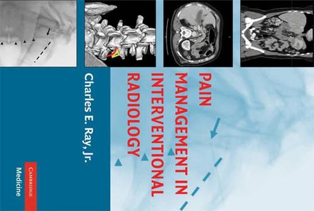 Pain Management in Interventional Radiology, 9780521865920