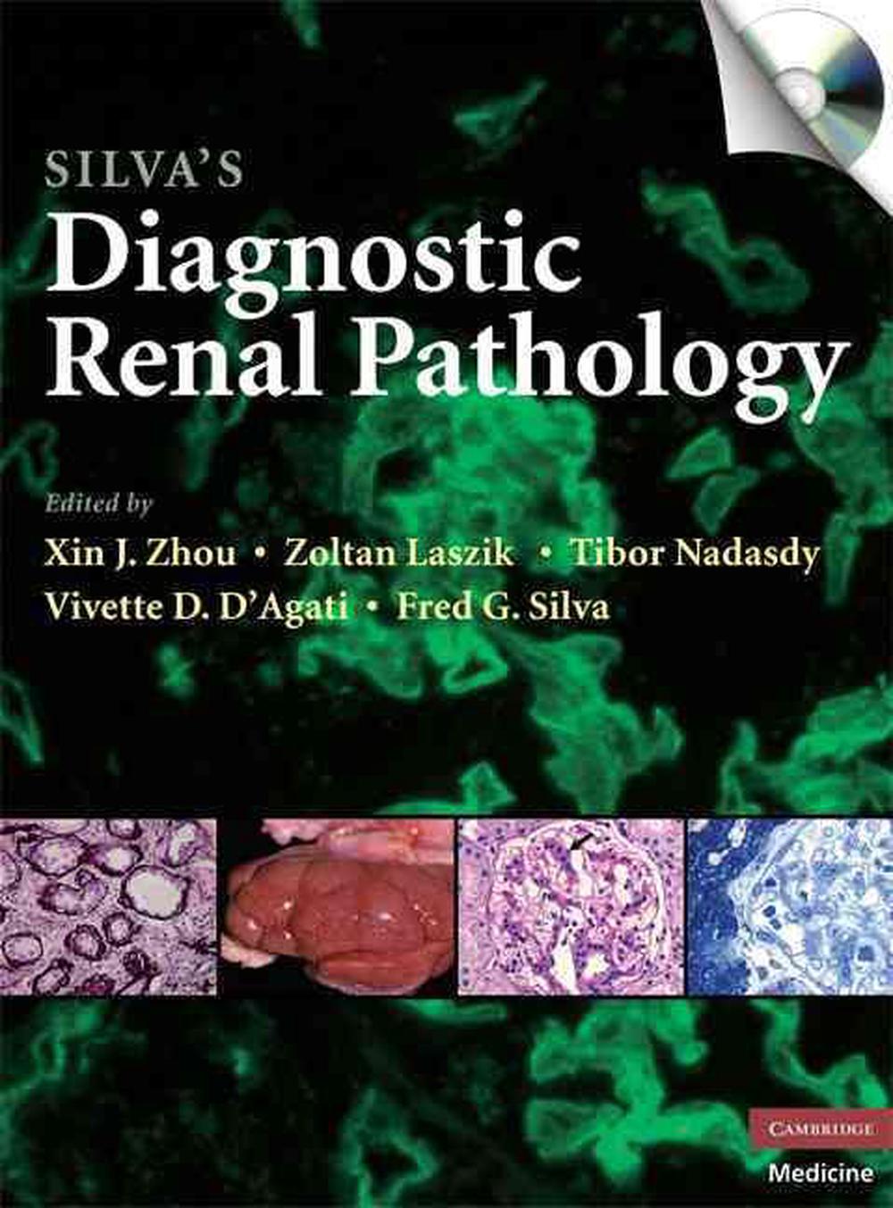 Silva's Diagnostic Renal Pathology, 9780521877022