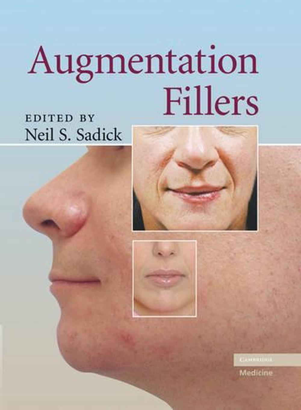 Augmentation Fillers, 9780521881128