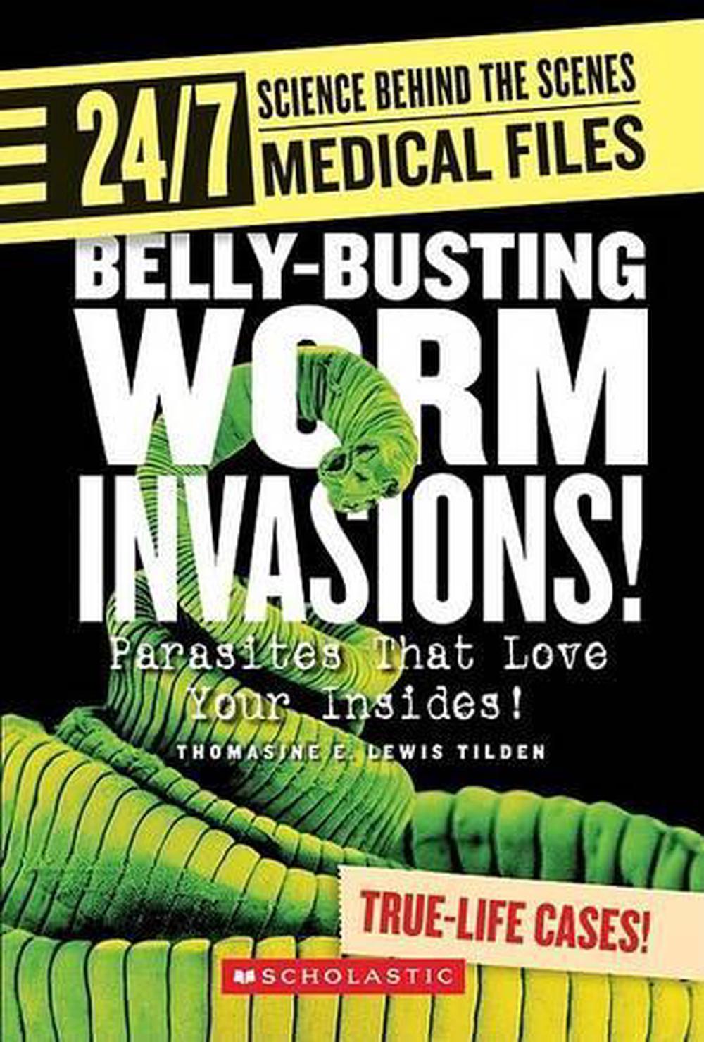 belly-busting-worm-invasions-parasites-that-love-your-insides-by-thomasine-e-lewis-tilden