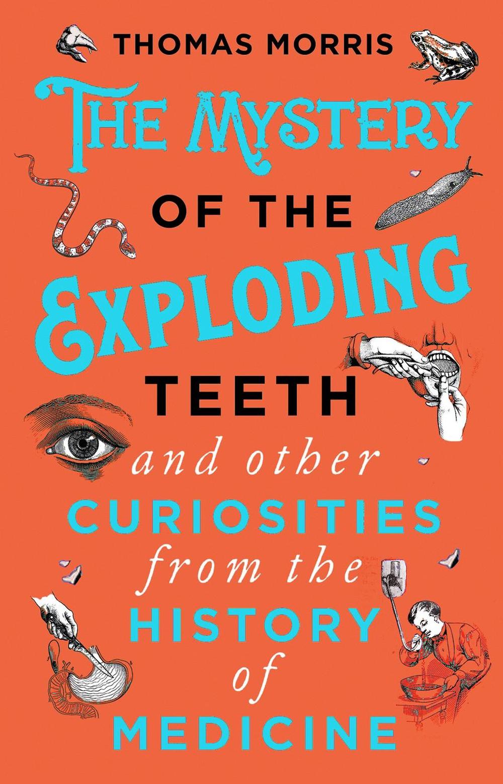 The Mystery of the Exploding Teeth and Other Curiosities from the History of Medicine by Thomas Morris - ISBN: 9780552175456