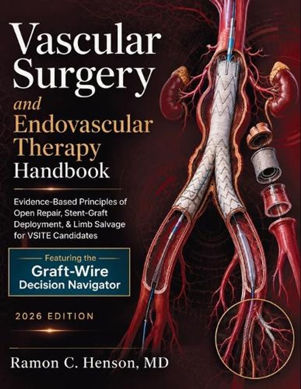 Vascular Surgery and Endovascular Therapy Handbook by Ramon C. Henson - ISBN: 9780557981557