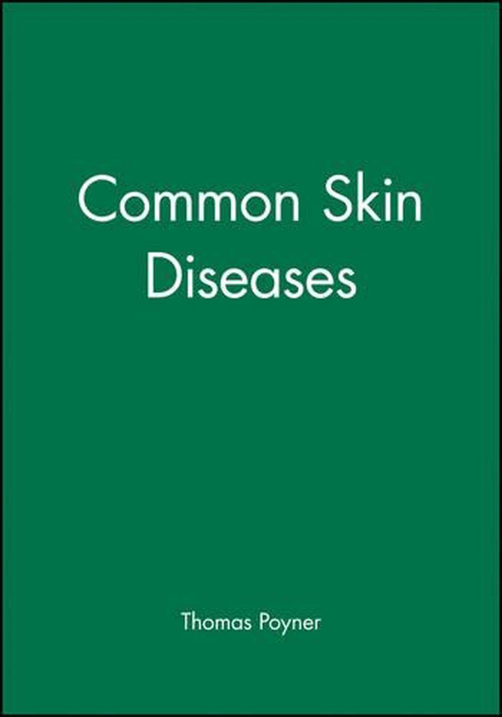 Common Skin Diseases, 1st Edition, 9780632051342