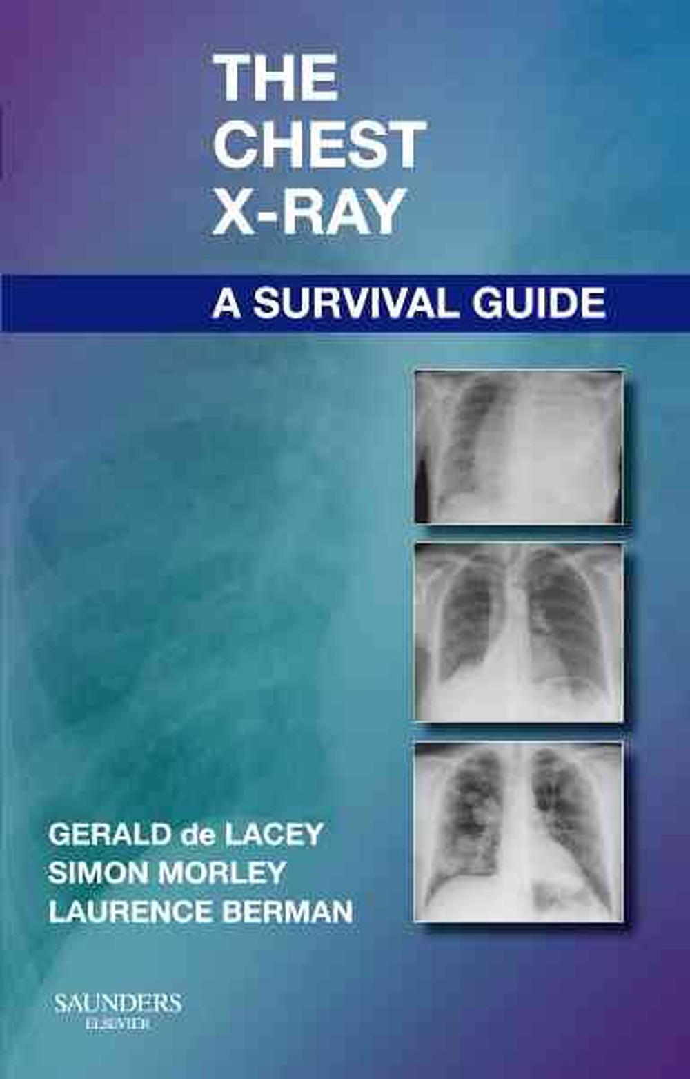 The Chest X-Ray: A Survival Guide, 1st Edition, 9780702030468