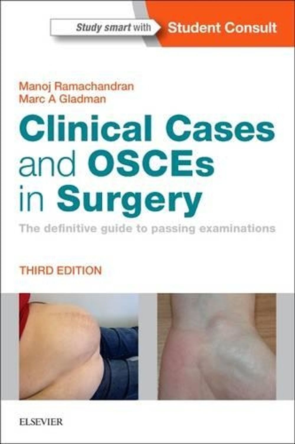 Clinical Cases and OSCEs in Surgery, 3rd Edition by Manoj Ramachandran - ISBN: 9780702066290