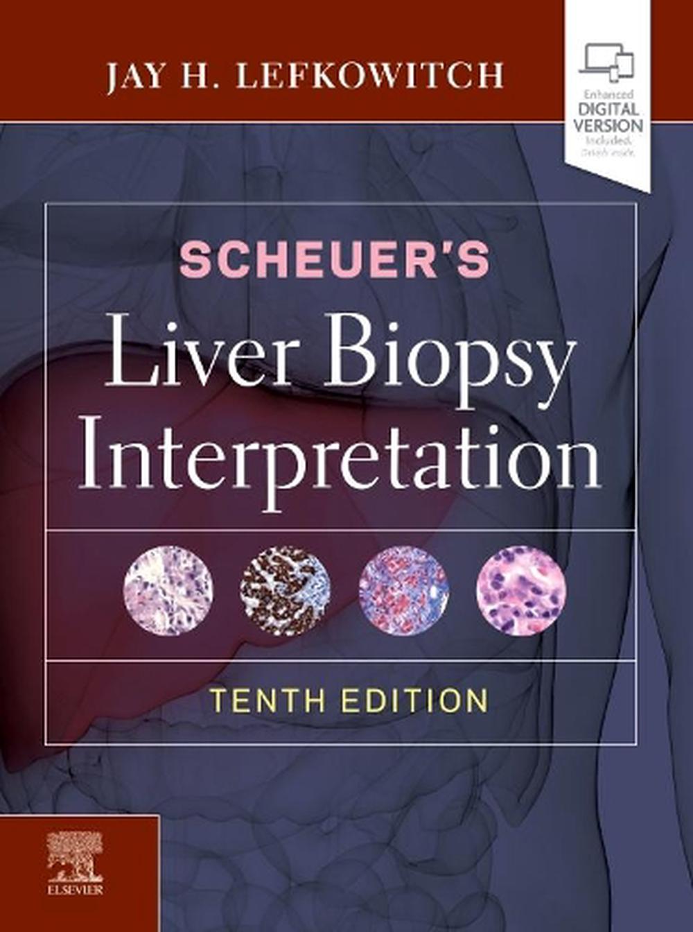 Scheuer's Liver Biopsy Interpretation, 9780702075841