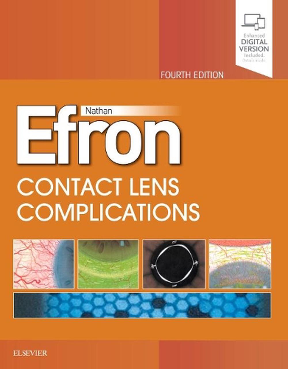 Contact Lens Complications, 9780702076114