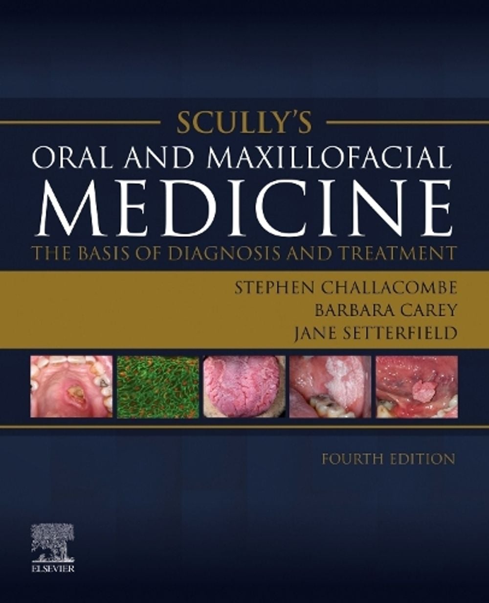 Scully's Oral and Maxillofacial Medicine: The Basis of Diagnosis and Treatment, 4th Edition by Stephen J. Challacombe - ISBN: 9780702080111