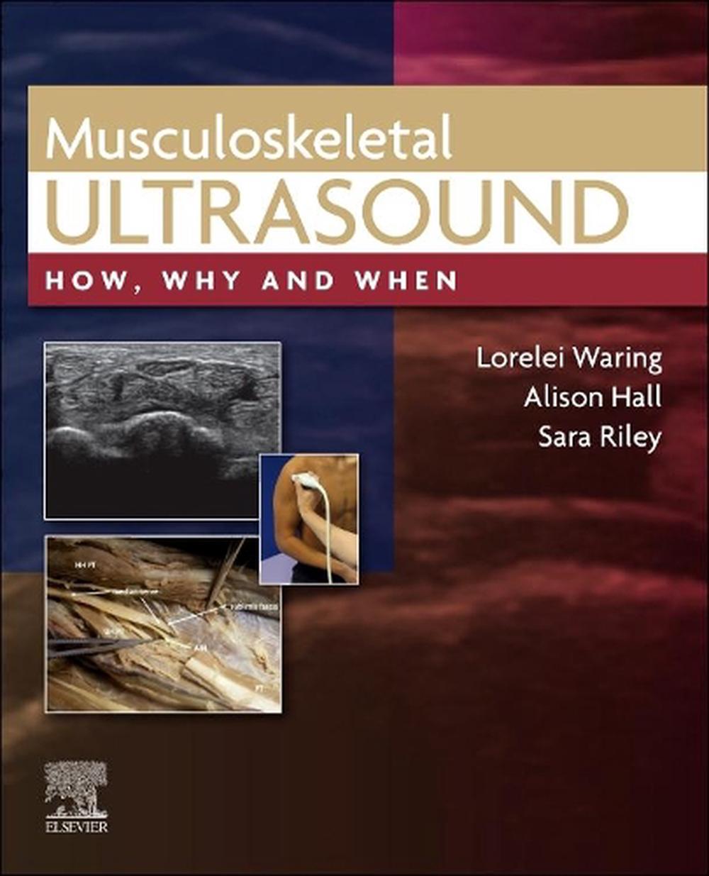Musculoskeletal Ultrasound, 9780702081989