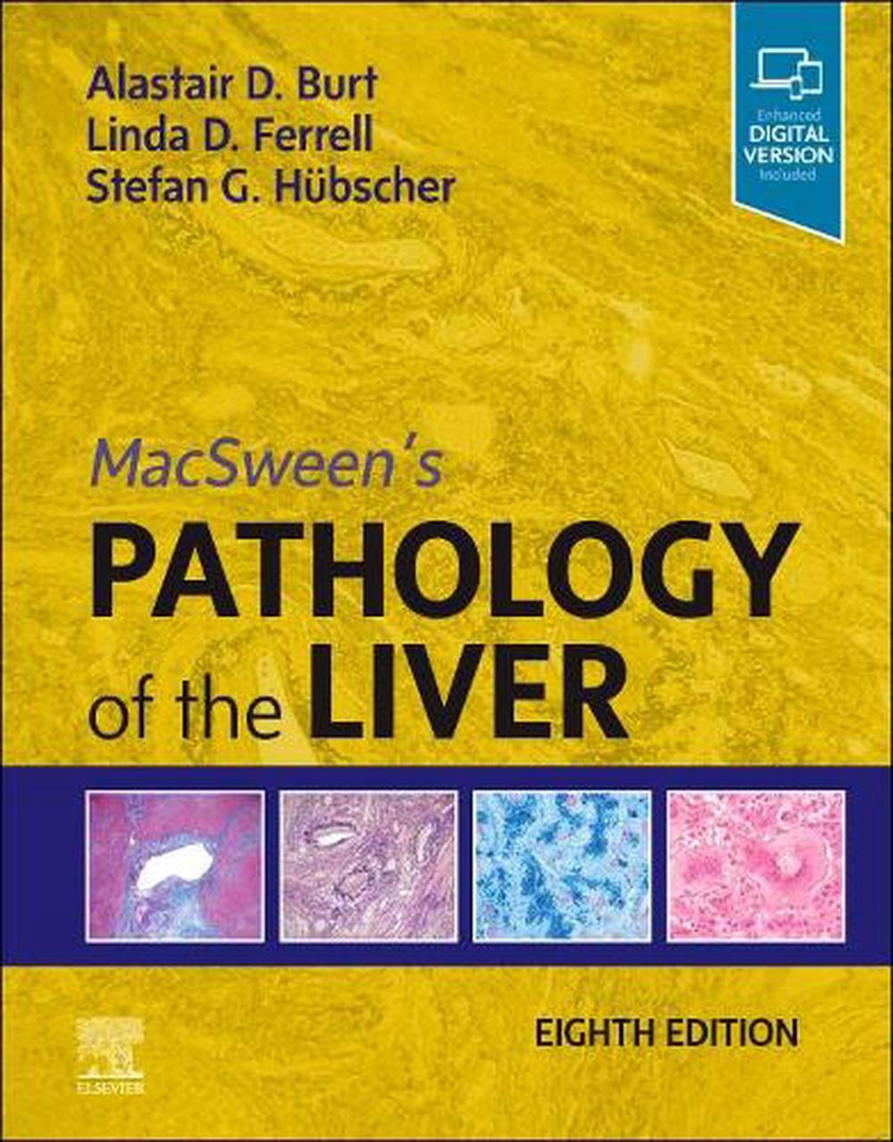 MacSween's Pathology of the Liver, 8th Edition, 9780702082283