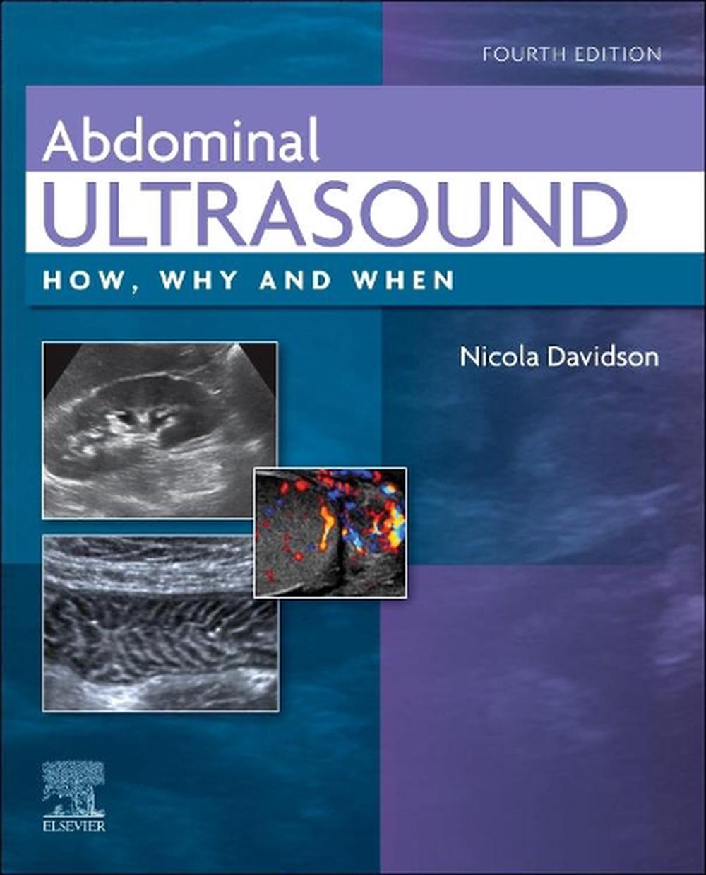 Abdominal Ultrasound, 4th Edition, 9780702082436