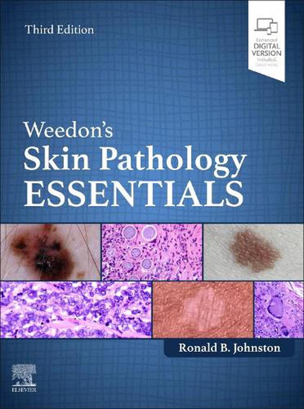 Weedon's Skin Pathology Essentials, 3rd Edition, 9780702084478