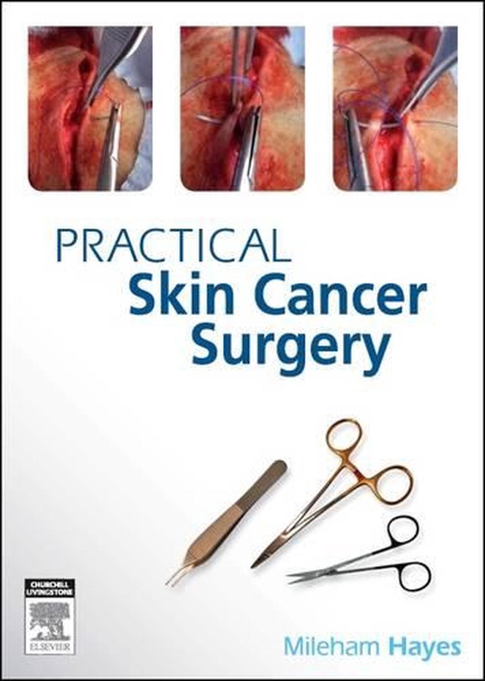 Practical Skin Cancer Surgery, 9780729539326