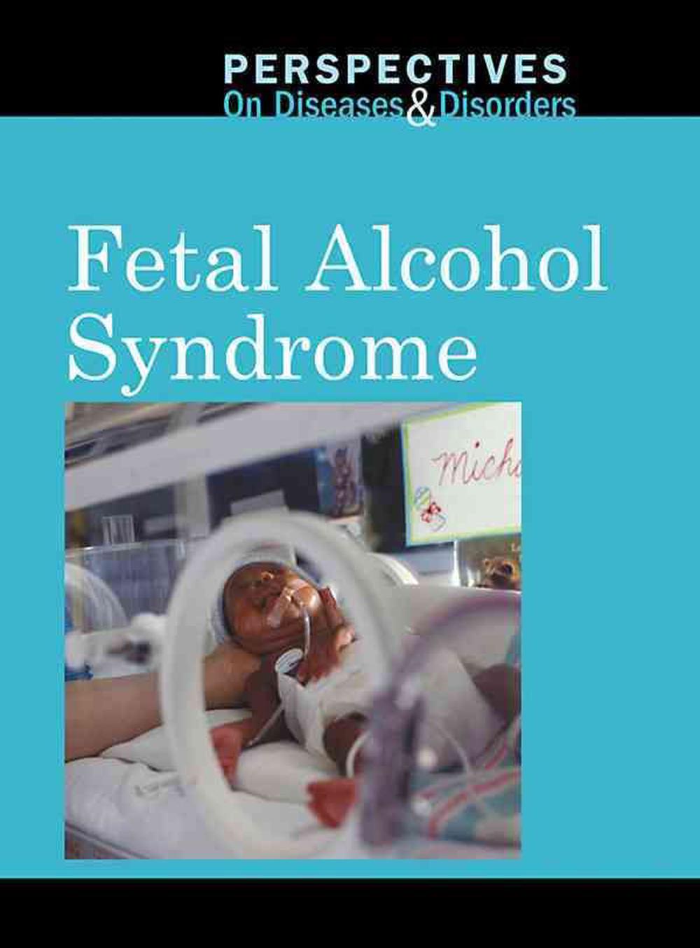 Fetal Alcohol Syndrome by Jacqueline Langwith, Library Binding ...