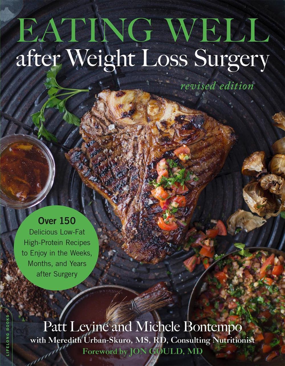 Eating Well after Weight Loss Surgery (Revised), 9780738235042