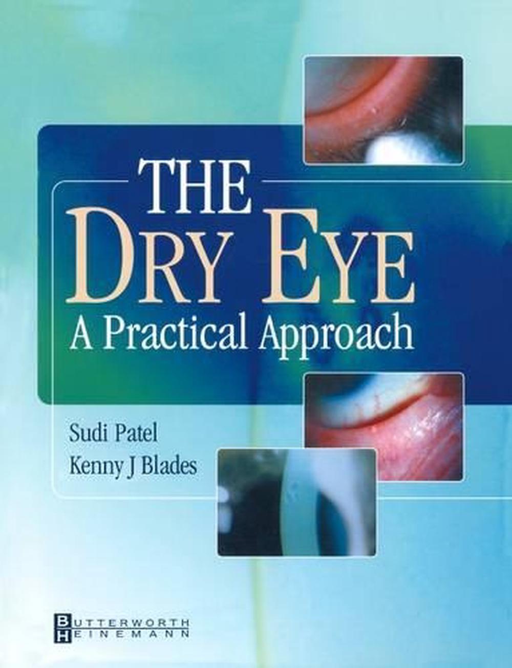The Dry Eye, 9780750649780