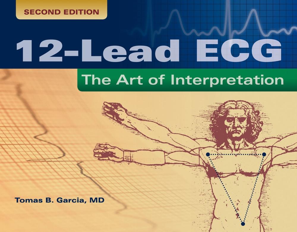 12-Lead ECG: the Art of Interpretation, 2nd Edition, 9780763773519