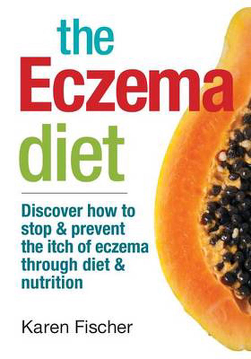 The Eczema Diet Discover How to Stop and Prevent the Itch