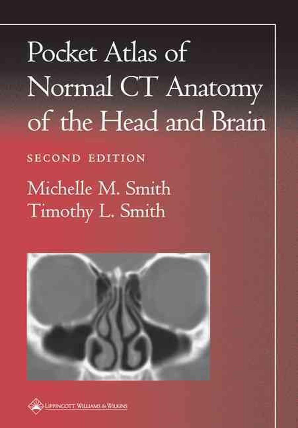 Pocket Atlas of Normal CT Anatomy of the Head and Brain, 2nd Edition, 9780781729499