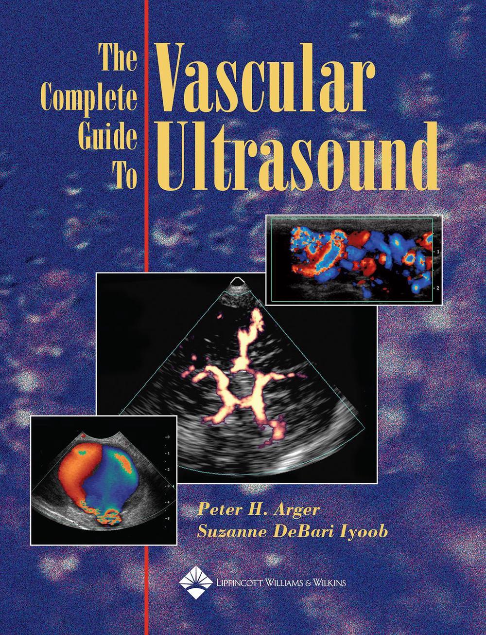The Complete Guide to Vascular Ultrasound, 1st Edition, 9780781753463