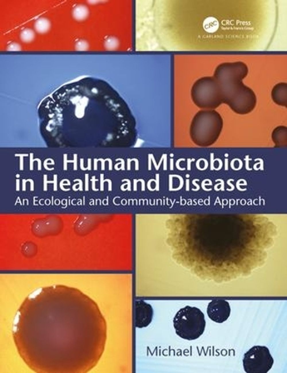 The Human Microbiota in Health and Disease by Michael Wilson - ISBN: 9780815345855