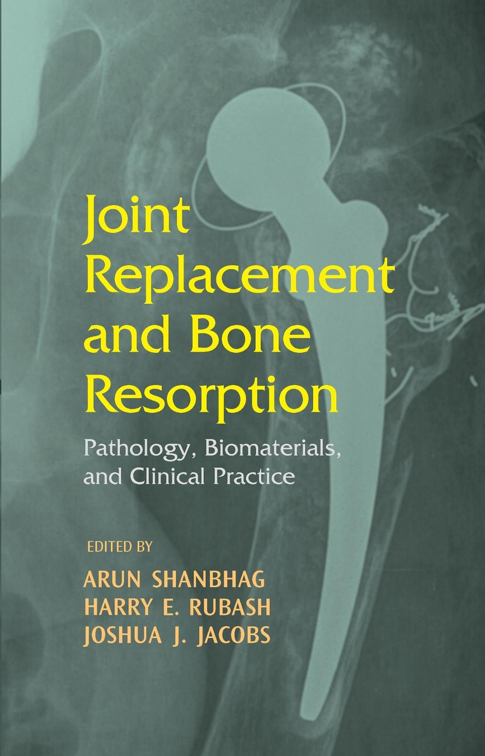 Joint Replacement and Bone Resorption, 1st Edition by Arun Shanbhag - ISBN: 9780824729547