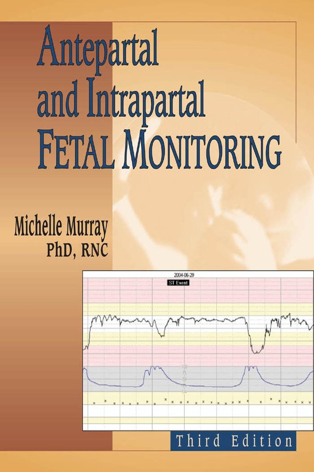 Antepartal and Intrapartal Fetal Monitoring, 9780826132628