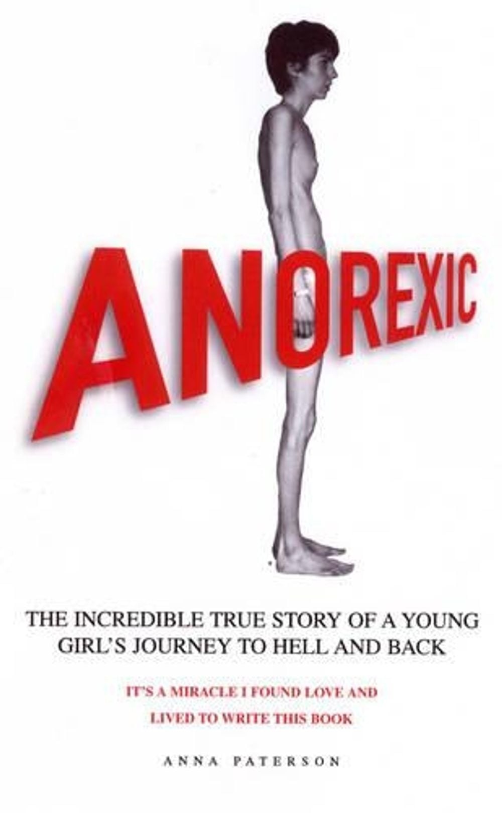 Anorexic by Anna Paterson - ISBN: 9780952921523