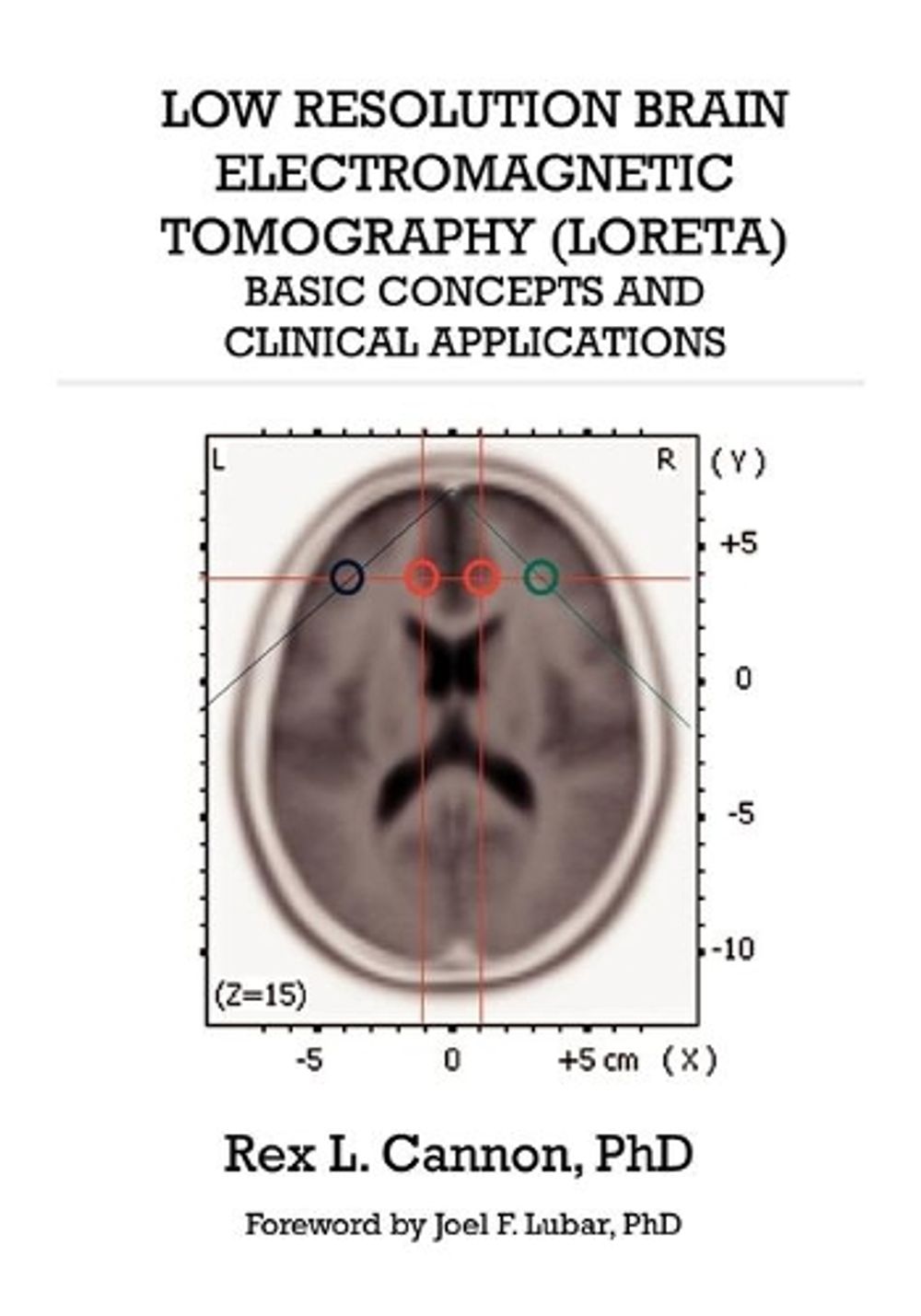 Low Resolution Brain Electromagnetic Tomography (LORETA) by Rex Cannon - ISBN: 9780982749814