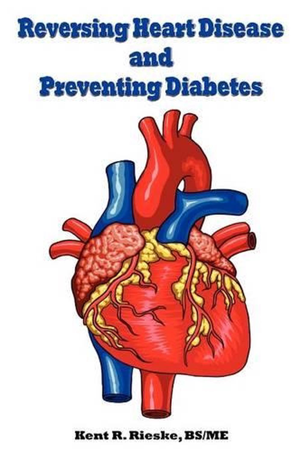 Reversing Heart Disease and Preventing Diabetes Apply Science to Lower