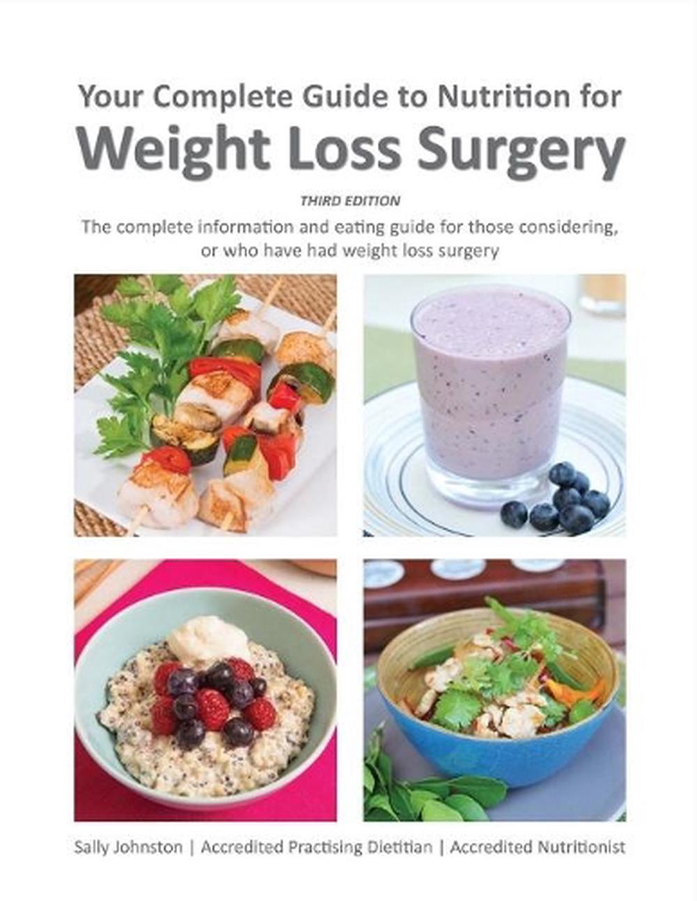 Your Complete Guide to Nutrition for Weight Loss Surgery by Sally