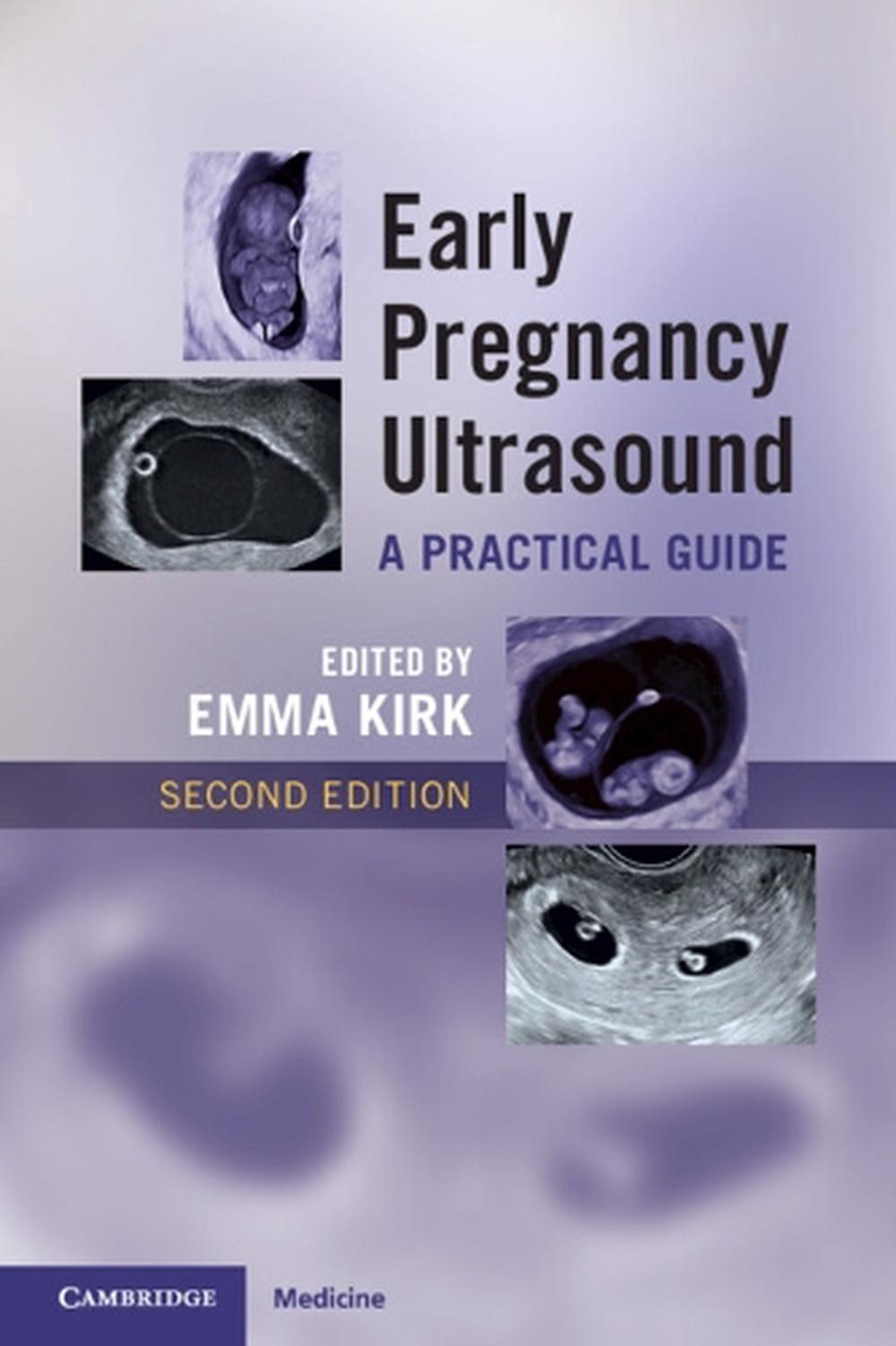 Early Pregnancy Ultrasound, 9781009519021