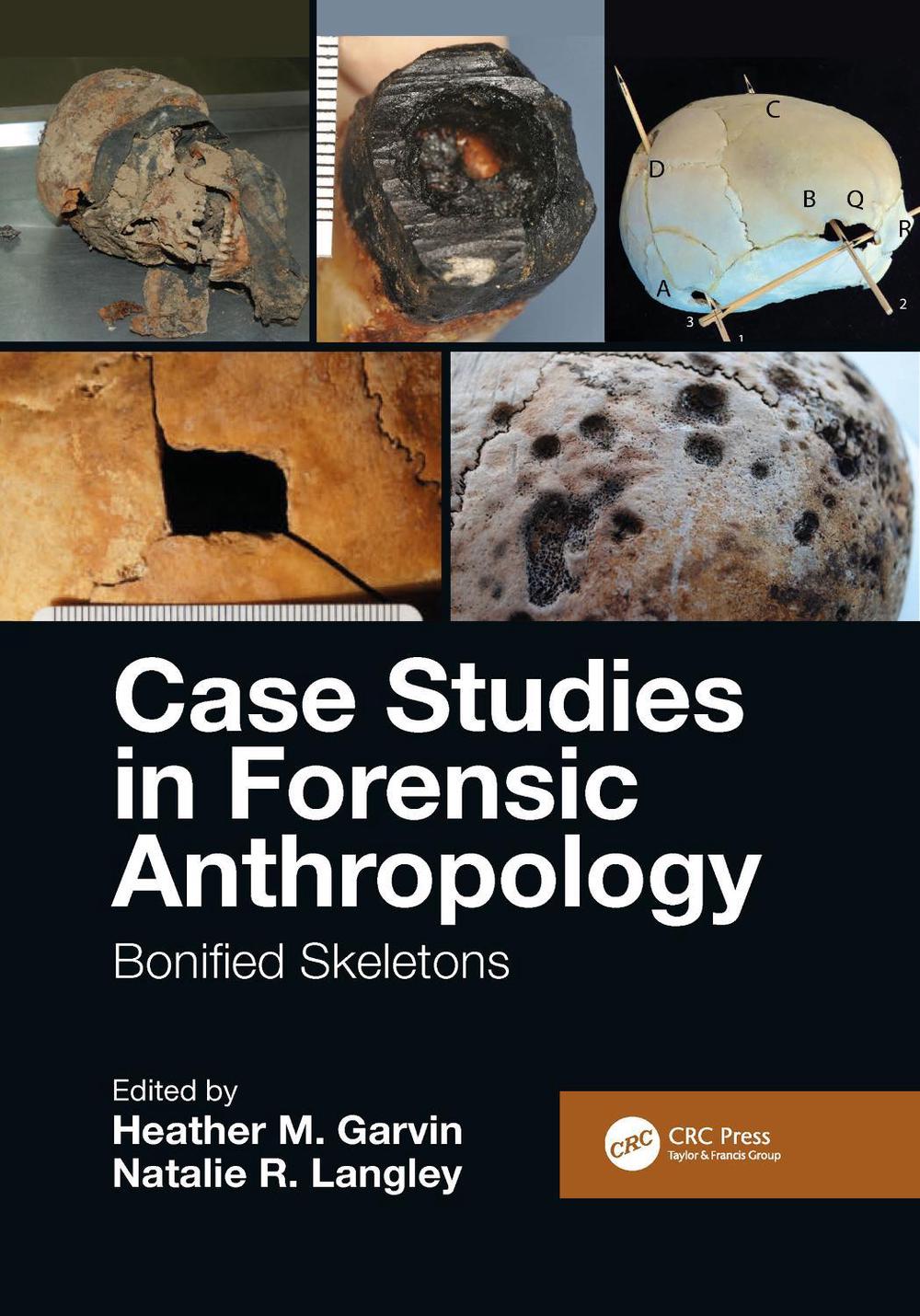 Case Studies in Forensic Anthropology, 9781032086569