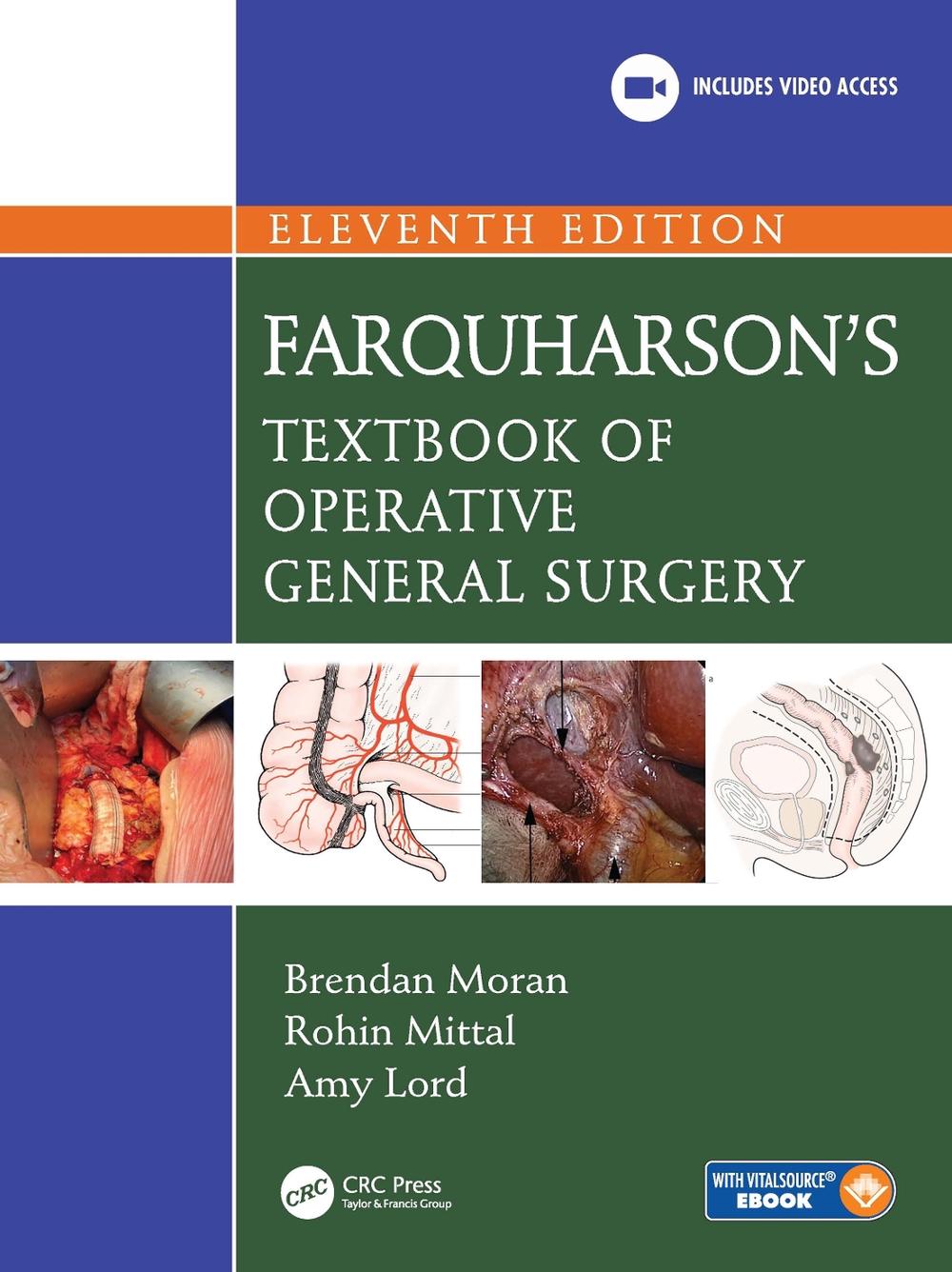 Farquharson's Textbook of Operative General Surgery, 11th Edition, 9781032376226