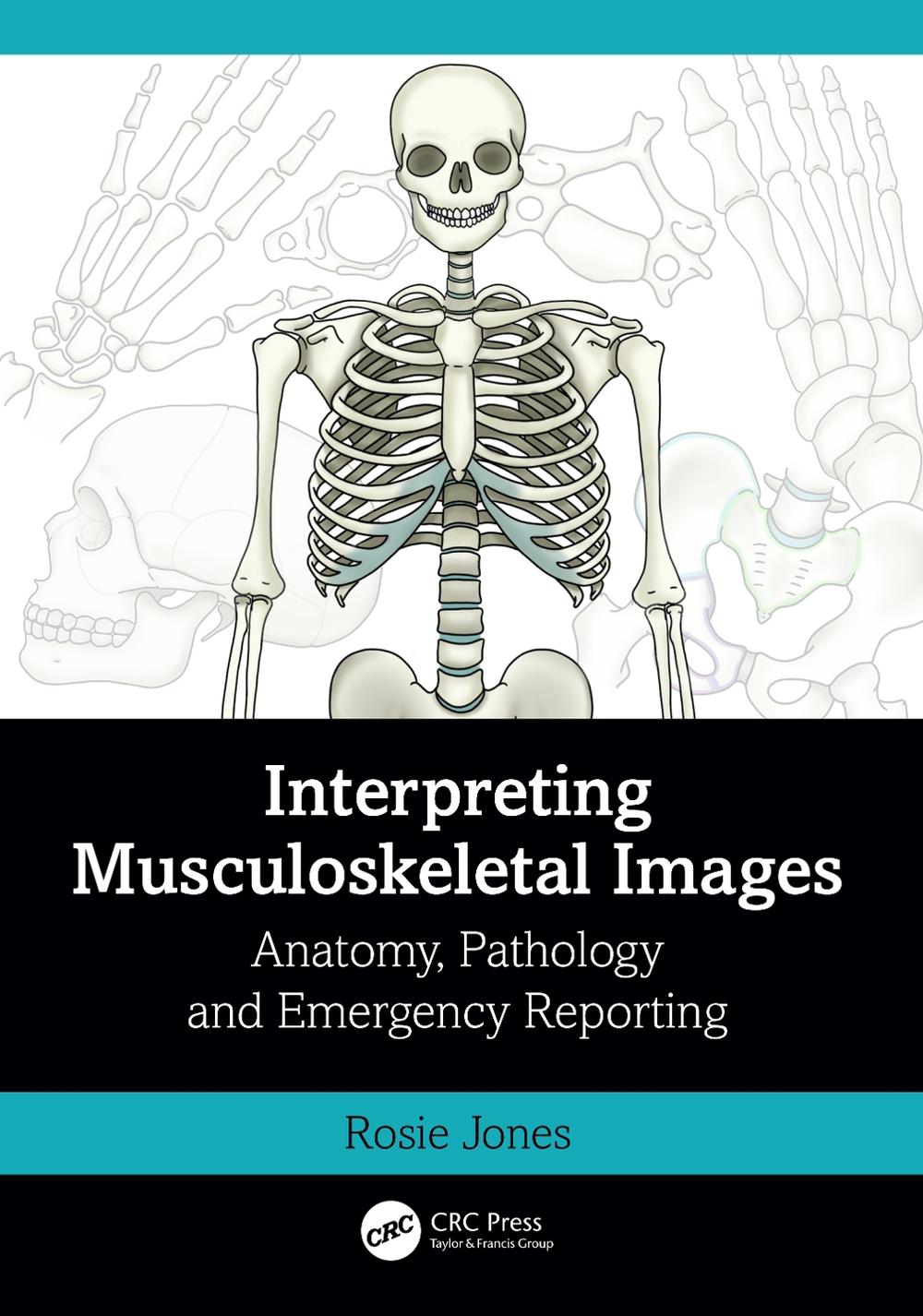 Interpreting Musculoskeletal Images, 9781032398914