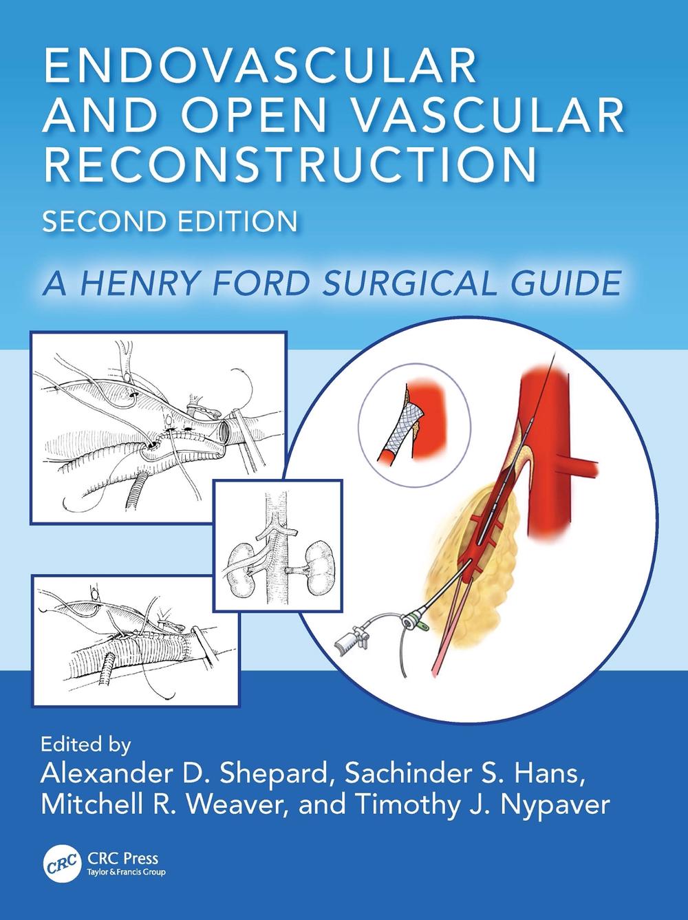 Endovascular and Open Vascular Reconstruction, 9781032433776