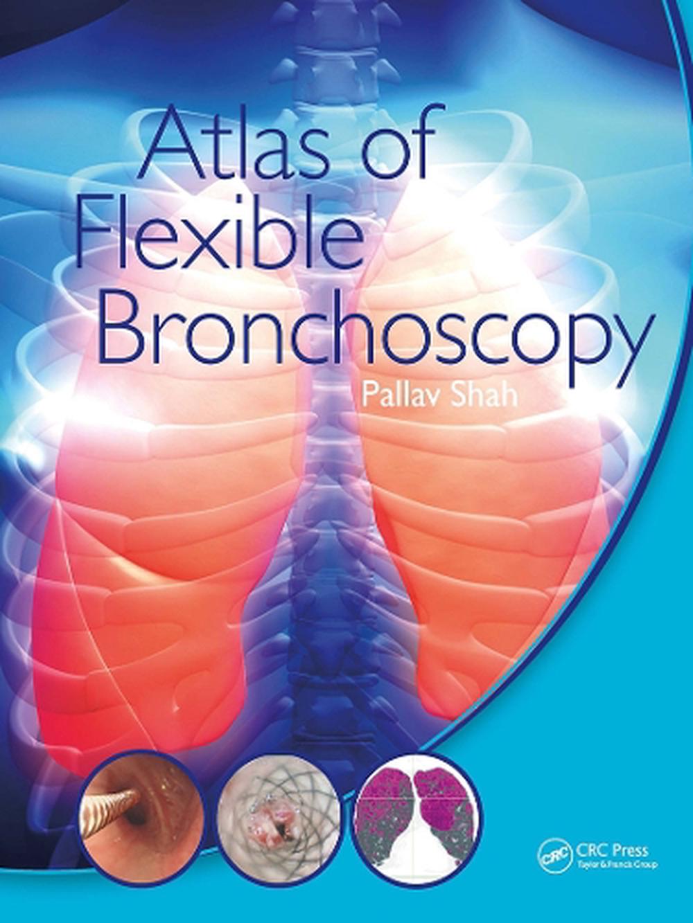 Atlas of Flexible Bronchoscopy, 9781032477589