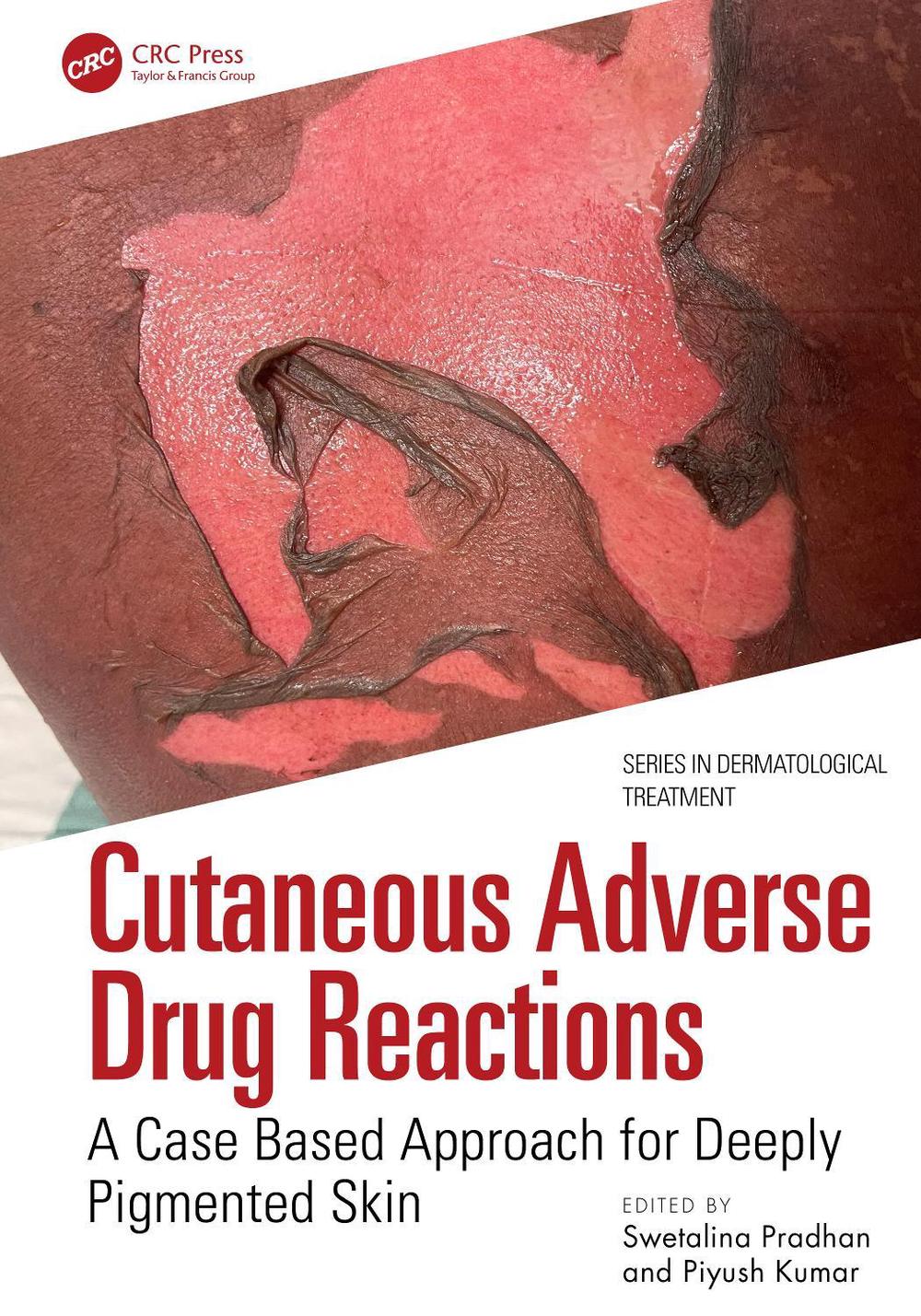 Cutaneous Adverse Drug Reactions, 9781032714554