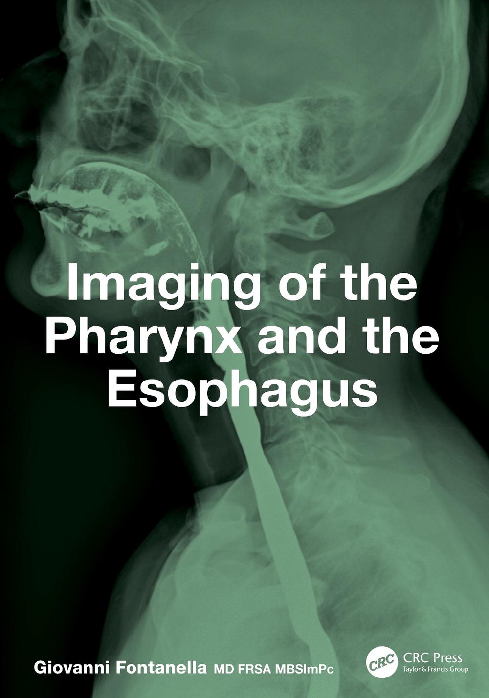 Imaging of the Pharynx and the Esophagus, 9781032791784