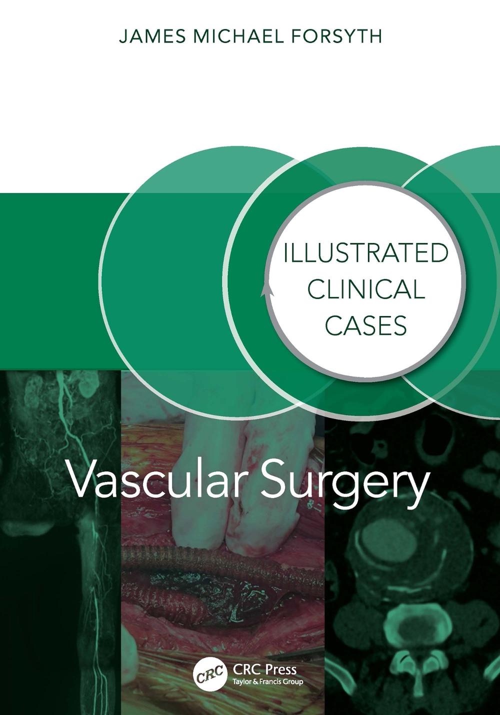 Vascular Surgery:, 9781032804828