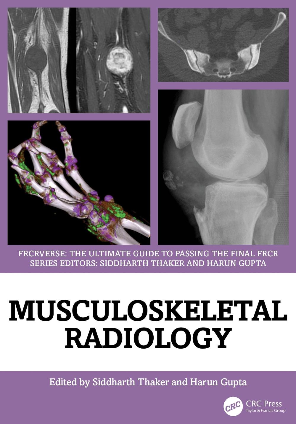 Musculoskeletal Radiology, 9781032815152