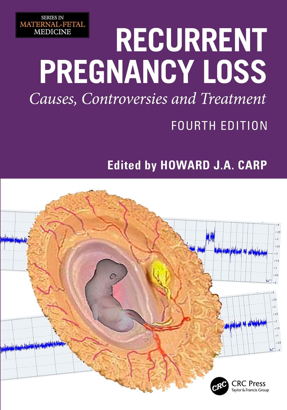 Recurrent Pregnancy Loss, 9781032825243