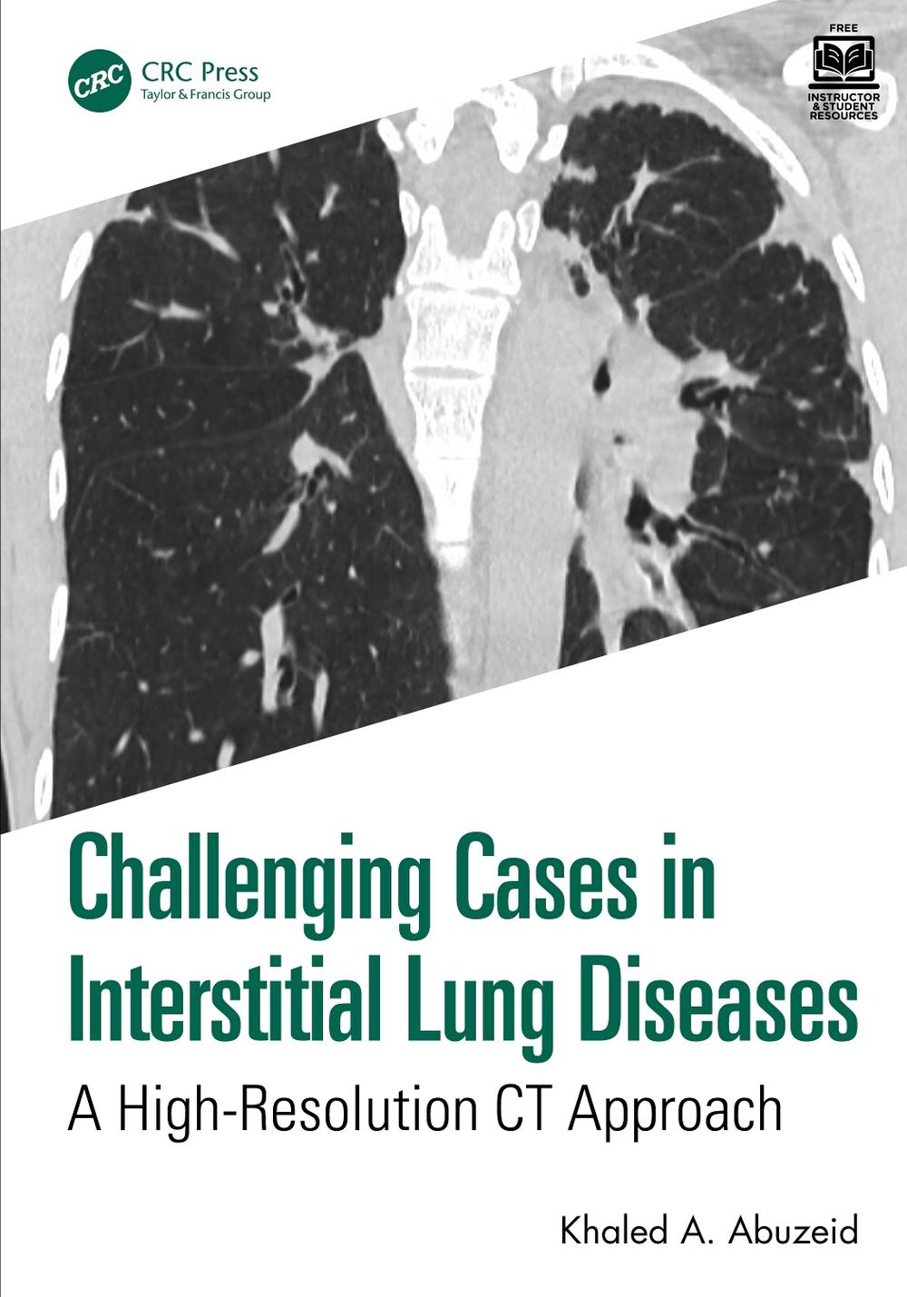 Challenging Cases in Interstitial Lung Diseases, 9781032950051