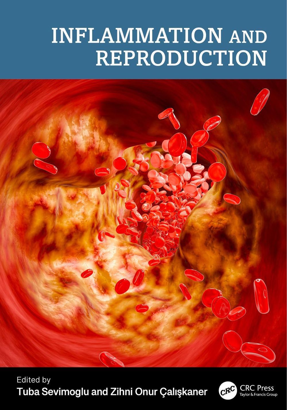 Inflammation and Reproduction by Tuba Sevimoglu - ISBN: 9781041109891