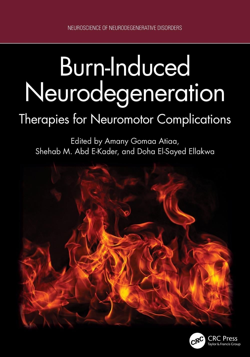 Burn-Induced Neurodegeneration by Amany Gomaa Atiaa - ISBN: 9781041144854